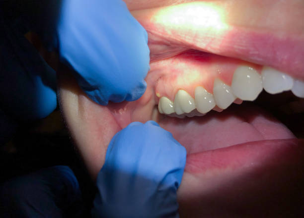Best Emergency Dental Care for Trauma or Injury in Crooked Lake Park, FL